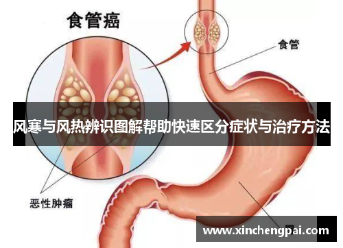 风寒与风热辨识图解帮助快速区分症状与治疗方法